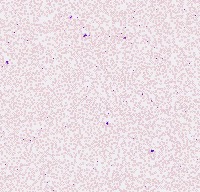 Blood smear project project thumbnail