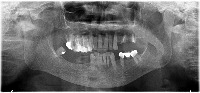 Dentex_updated project thumbnail