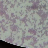 AI_WaBacteria project thumbnail
