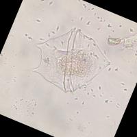 Marine_Microorganisms  project thumbnail