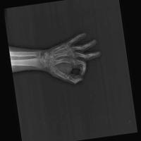 bone project thumbnail