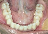 Mandibular 8j4rm project thumbnail