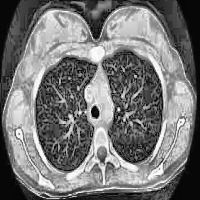 MRI Classification Classification Model by MRI