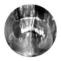 orignal without cavity project thumbnail