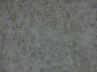 Hollow Membran Dialyzer project thumbnail