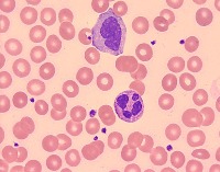 PeripheralBloodSmear project thumbnail