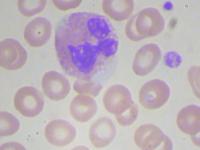 Blood project thumbnail