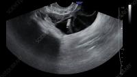 Follicle monitoring and analysis project thumbnail