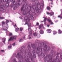 CRC Tissue Detection project thumbnail