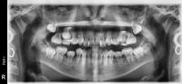 Panoramic project thumbnail