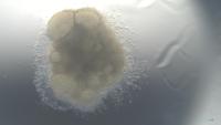 Follicle Segmentation project thumbnail