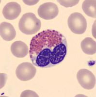 BLOOD project thumbnail