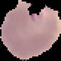 Malaria Test project thumbnail