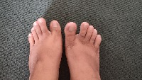 toenail detection project thumbnail