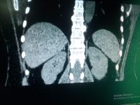 CT_Detection project thumbnail