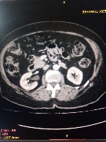 CT_Classification project thumbnail