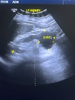 Ultrasound_classification project thumbnail