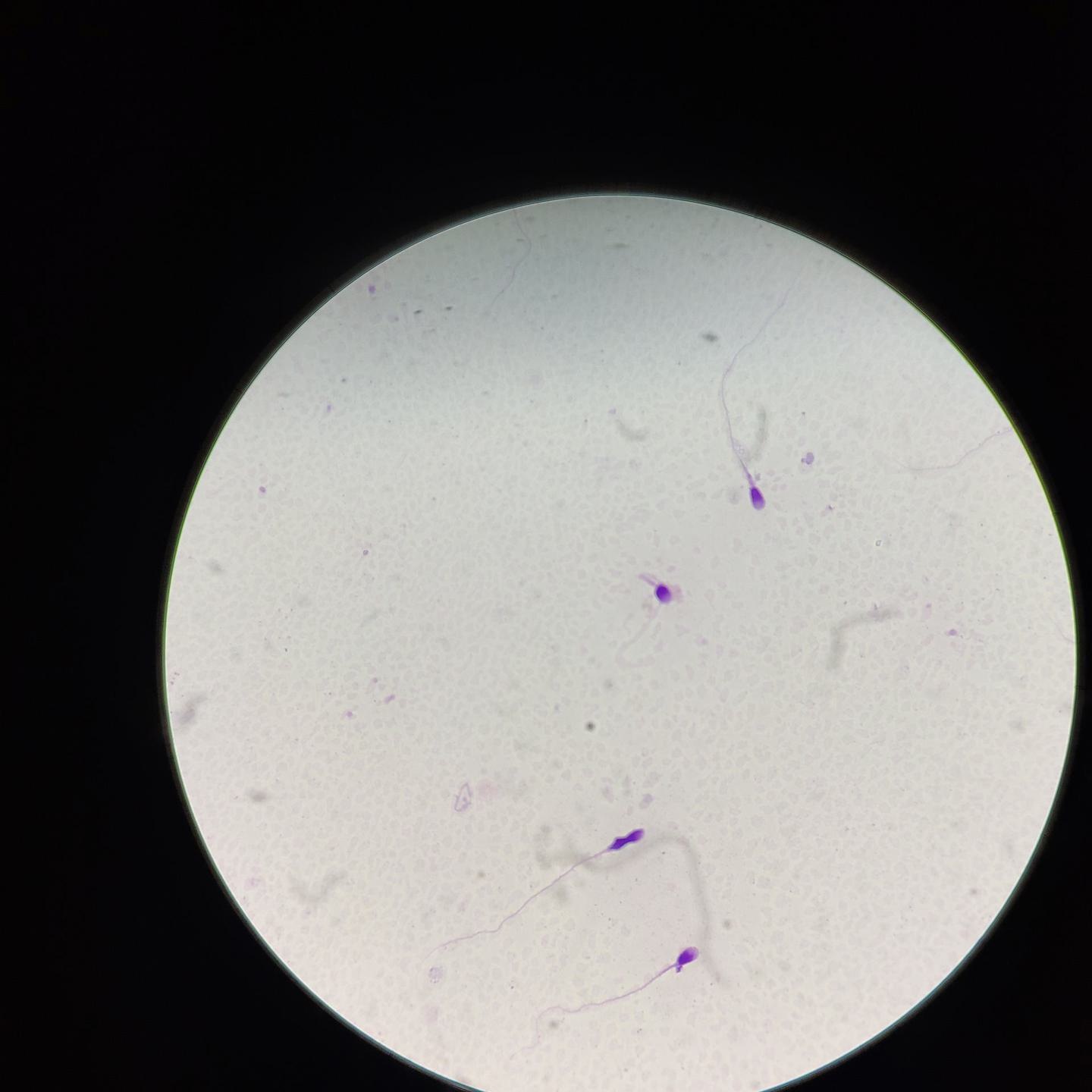 Sperm Detection Sperm Detection Object Detection Dataset by Enes