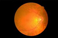 dr detection project thumbnail