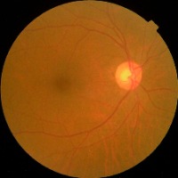 dr detection2 project thumbnail