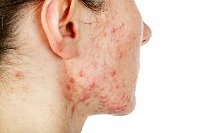 Face skin health project thumbnail