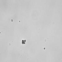 urine-crystals-moreDiandUric project thumbnail