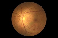 dr-lesions project thumbnail