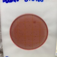 Coliform_TNTC_or_not project thumbnail