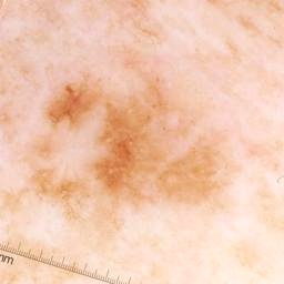 Malignant Classification Dataset by mydata