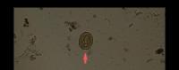 Ascaris Lumbricoides BB project thumbnail