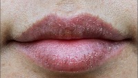 LipStatus project thumbnail