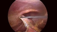 detect project thumbnail