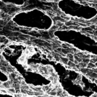Vasolidation Detect project thumbnail