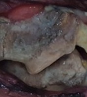 dog dental project thumbnail