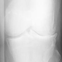 Knee Object Detection Model by Sainaws Workspace