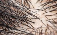 hair_count project thumbnail