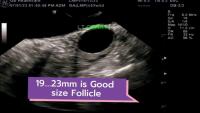Test Follicles project thumbnail
