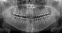 dseg3_f5_valid_test project thumbnail