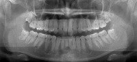 dseg3_f4_valid_test project thumbnail