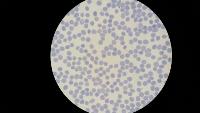 Palu_diagnosis project thumbnail