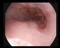 gastro project thumbnail