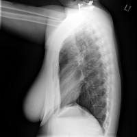 Xray100Images project thumbnail