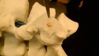 evil tumor f block project thumbnail