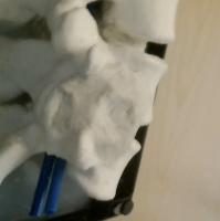 BEE AI Spine Model project thumbnail