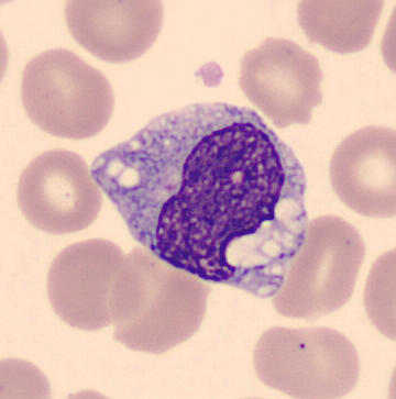 Unbelievable Secret Inside Immature Granulocytes That Will Shock You