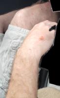 SkinSegmentation2 project thumbnail