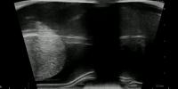 InflatablePhantomSegmentation project thumbnail