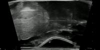 RectumProstate project thumbnail