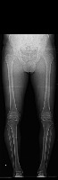 Legs 2 Yolo8 project thumbnail