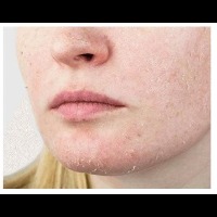 Skin_Types project thumbnail